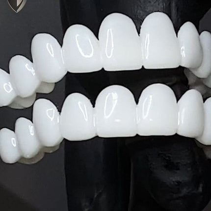 Smile Restore | Dental Prosthetics for Missing Teeth with Custom Fit | Natural Look for Enhanced Confidence 4