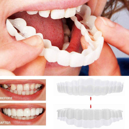 Smile Transformation | Removable Veneers Set for Natural Look & Comfort | Perfect Solution for Your Smile 0