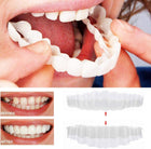 Smile Transformation | Removable Veneers Set for Natural Look & Comfort | Perfect Solution for Your Smile 0