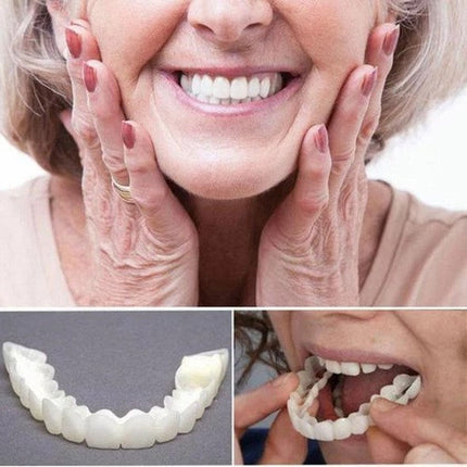 Smile Transformation | Removable Veneers Set for Natural Look & Comfort | Perfect Solution for Your Smile 1