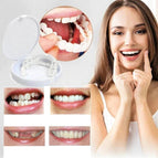 Upper Teeth