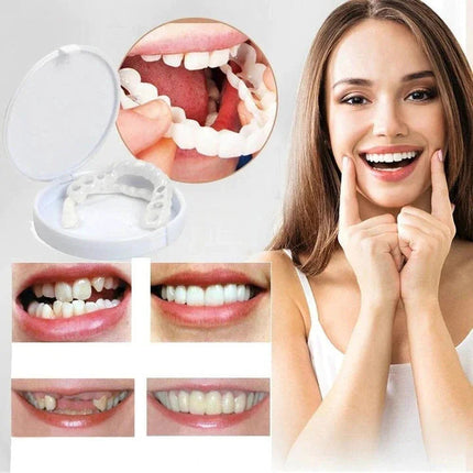 Snap-On Veneers Set for Upper & Lower Teeth with Custom Fit | Removable Solution for a Natural-Looking Smile 0