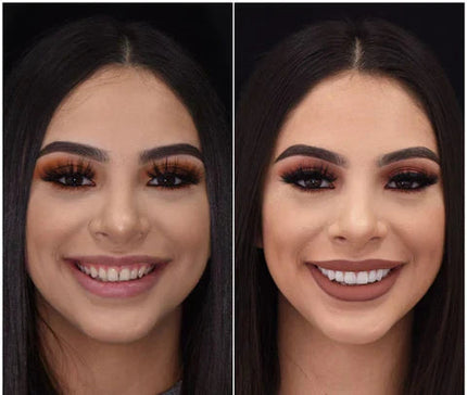 Snap-On Veneers Set for Upper & Lower Teeth with Custom Fit | Removable Solution for a Natural-Looking Smile 6