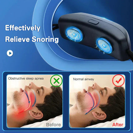 Snooze Smart Device | Anti-Snoring, USB Rechargeable 3