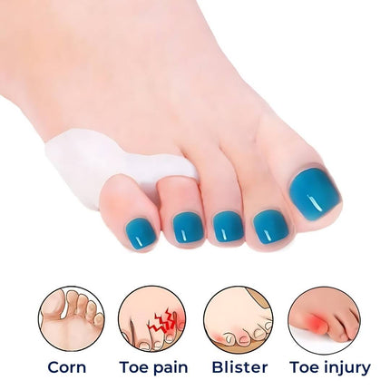 ToeGuard | Orthopedic Toe Spacers for Bunionette Correction & Toe Alignment | Comfortable Design for Pain Relief 2