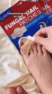 Nail Repair Patches for Toenails and Fingernails, Nail Fungus Patches with Tea Tree Oil