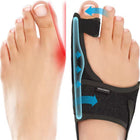 Bunion Night Splints for Hallux Valgus, Ergonomic Foot Care for Toe Alignment – image 5