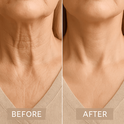 Neck Tape, Invisible Neck Lifting Tape for Sagging Skin – image 4