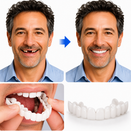 Veneer Smile | Tooth Replacement Kit with Natural Look & Comfort | Easy-to-Use Solution for Perfect Teeth