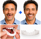 Veneer Smile | Tooth Replacement Kit with Natural Look & Comfort | Easy-to-Use Solution for Perfect Teeth