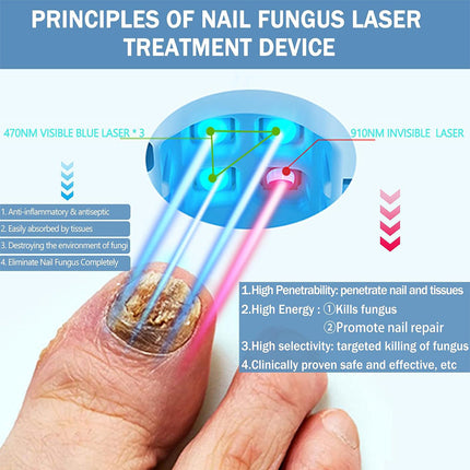 Toenail Fungus Laser Device for Home Use, Blue Light Therapy and Infrared Light Therapy – image 7