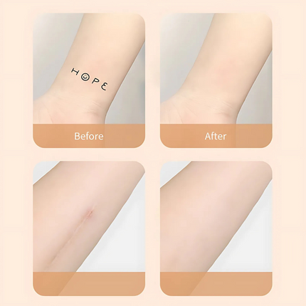 Scar Patch, Water Resistant Skin Patch in Skin Tone Shades – image 5