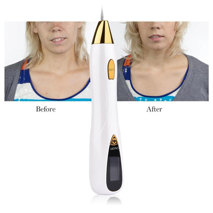 Skin Tag Remover Pen, Skin Tag Removal Kit for Freckles and Spots